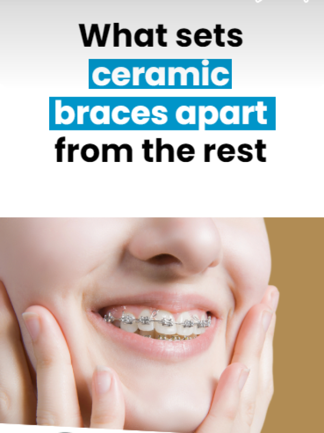 What sets ceramic braces apart from the rest
