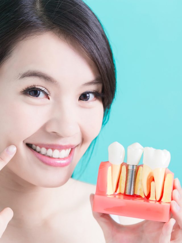 Types of Dental Implant Procedures